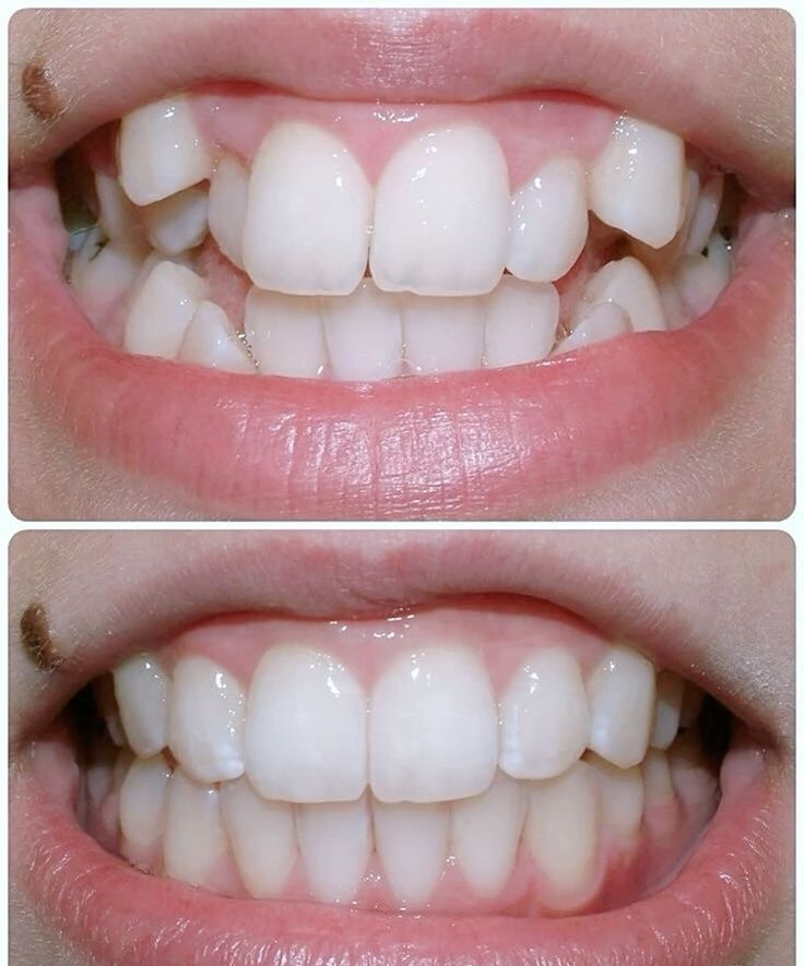 Children's Dentistry at EverSmile
