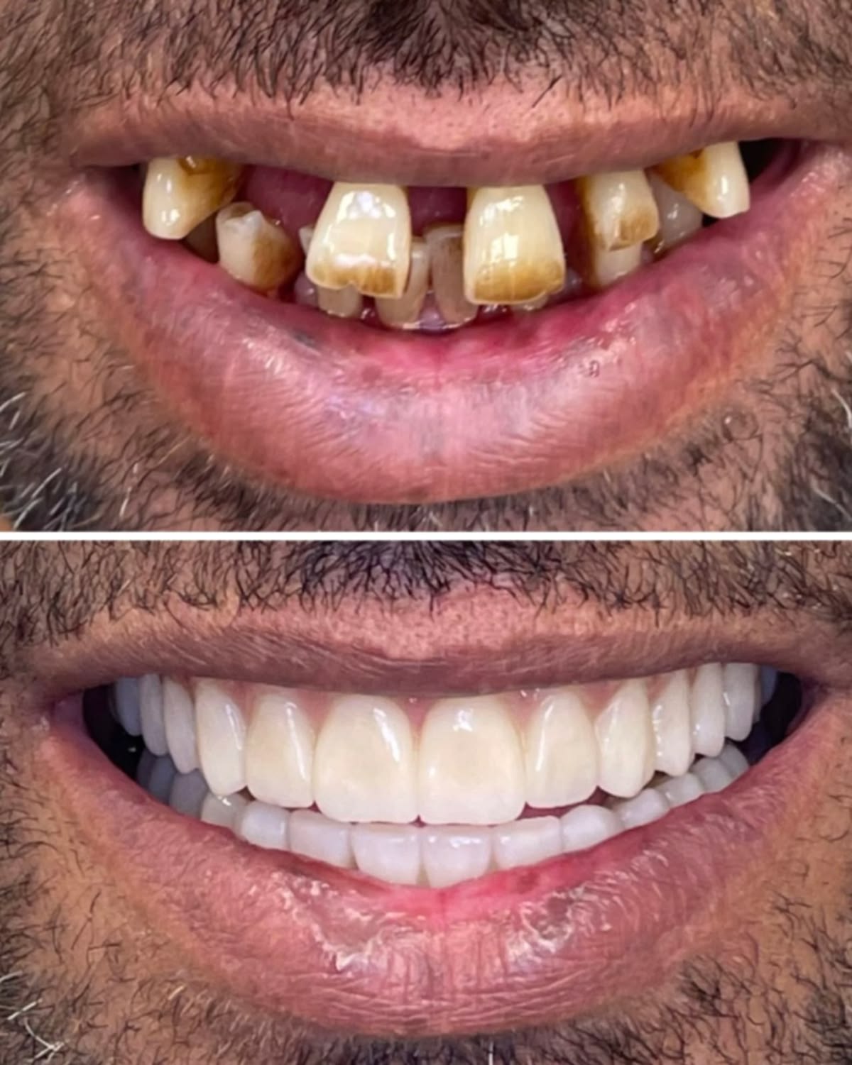 Cosmetic Dentistry at EverSmile