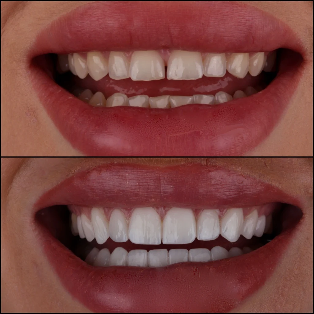 Cosmetic Dentistry at EverSmile