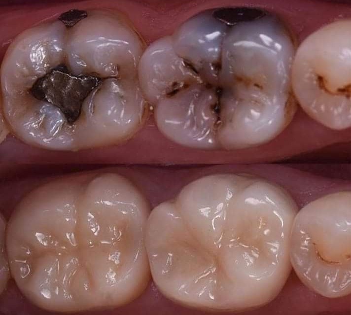 General Dentistry at EverSmile