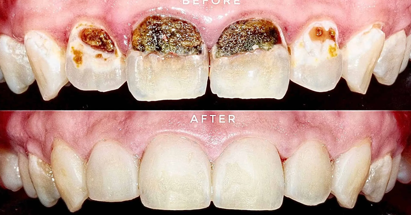 General Dentistry at EverSmile