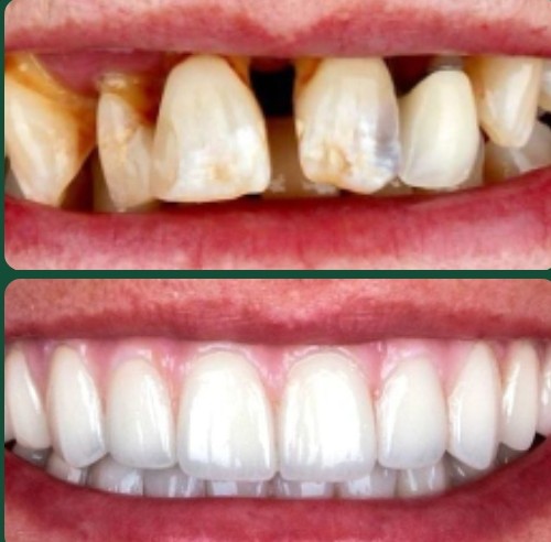 General Dentistry at EverSmile